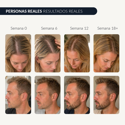 roll-on serum capilar, barba y cejas